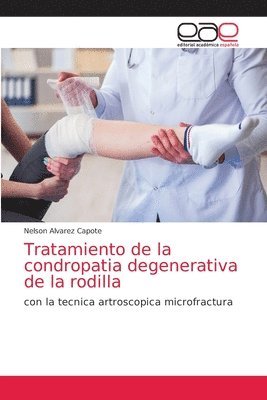 bokomslag Tratamiento de la condropatia degenerativa de la rodilla