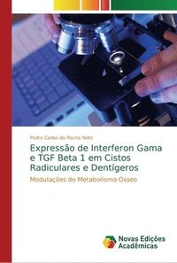 bokomslag Expresso de Interferon Gama e TGF Beta 1 em Cistos Radiculares e Dentgeros
