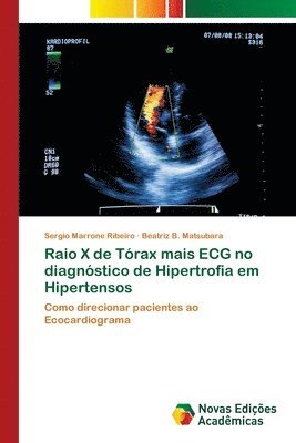 bokomslag Raio X de Trax mais ECG no diagnstico de Hipertrofia em Hipertensos