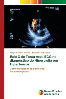 Raio X de Trax mais ECG no diagnstico de Hipertrofia em Hipertensos 1