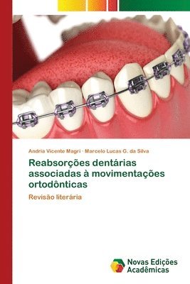 Reabsores dentrias associadas  movimentaes ortodnticas 1