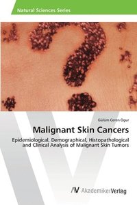 bokomslag Malignant Skin Cancers