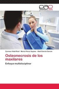 bokomslag Osteonecrosis de los maxilares