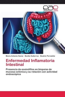 Enfermedad Inflamatoria Intestinal 1