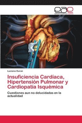 Insuficiencia Cardaca, Hipertensin Pulmonar y Cardiopata Isqumica 1