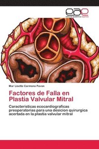 bokomslag Factores de Falla en Plastia Valvular Mitral