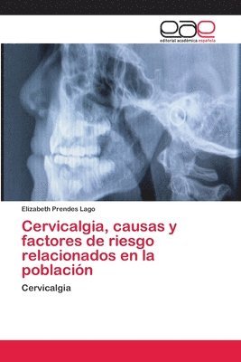 Cervicalgia, causas y factores de riesgo relacionados en la poblacin 1