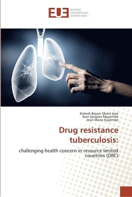 Drug resistance tuberculosis 1