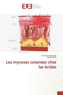 bokomslag Les mycoses cutanées chez les brûlés