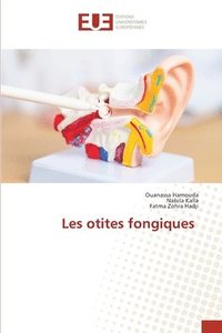 bokomslag Les otites fongiques