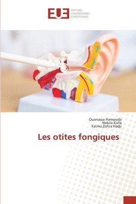 Les otites fongiques 1