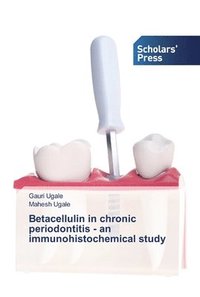 bokomslag Betacellulin in chronic periodontitis - an immunohistochemical study
