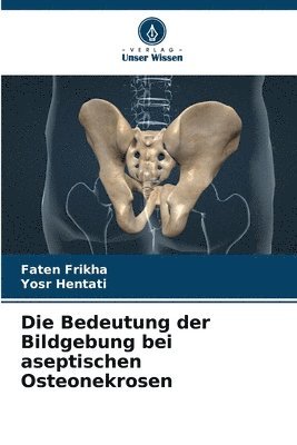 Bedeutung der Bildgebung bei aseptischen Osteonekrosen