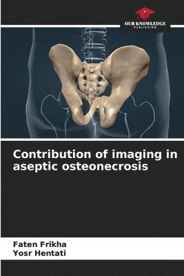 Contribution of imaging in aseptic osteonecrosis