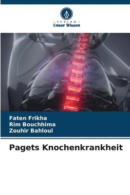 Pagets Knochenkrankheit