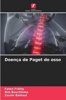 bokomslag Doença de Paget do osso