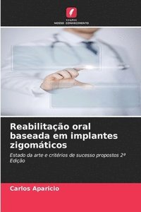 bokomslag Reabilitação oral baseada em implantes zigomáticos