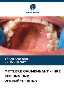 Shantanu Raut, Usha Shenoy - Mittlere Gaumennaht - Ihre Reifung Und Verknöcherung, Häftad