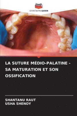 Shantanu Raut, Usha Shenoy - Suture Médio-Palatine - Sa Maturation Et Son Ossification, Häftad