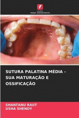 Shantanu Raut, Usha Shenoy - Sutura Palatina Média - Sua Maturação E Ossificação, Häftad
