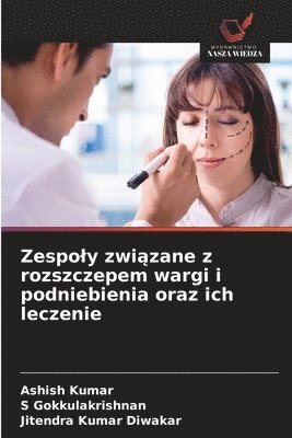 bokomslag Zespoly zwi?zane z rozszczepem wargi i podniebienia oraz ich leczenie