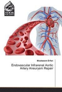 bokomslag Endovascular Infrarenal Aortic Artery Aneurysm Repair
