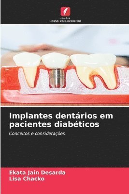 bokomslag Implantes dentários em pacientes diabéticos