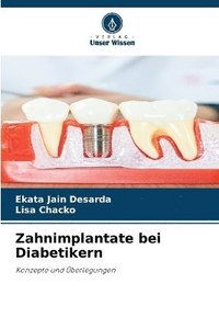 bokomslag Zahnimplantate bei Diabetikern
