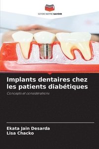 bokomslag Implants dentaires chez les patients diabétiques