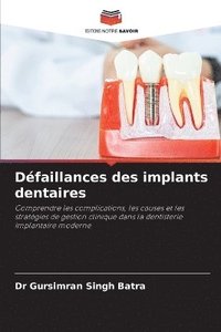 bokomslag Défaillances des implants dentaires