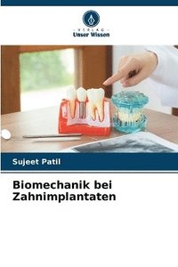 bokomslag Biomechanik bei Zahnimplantaten