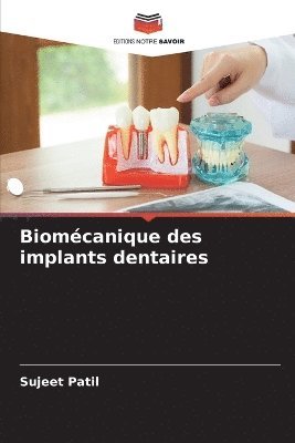 bokomslag Biomécanique des implants dentaires