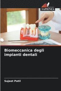 bokomslag Biomeccanica degli impianti dentali