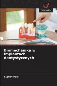 bokomslag Biomechanika w implantach dentystycznych