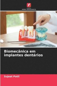 bokomslag Biomecânica em implantes dentários
