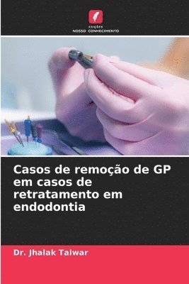 Casos de remoção de GP em casos de retratamento em endodontia