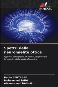 bokomslag Spettri della neuromielite ottica
