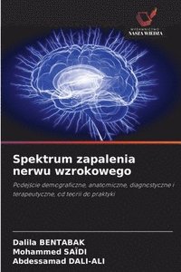 bokomslag Spektrum zapalenia nerwu wzrokowego