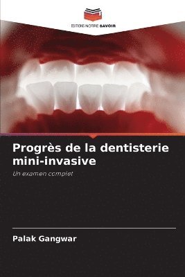bokomslag Progrès de la dentisterie mini-invasive