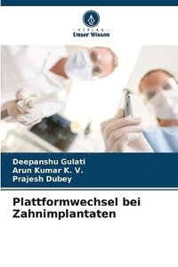 bokomslag Plattformwechsel bei Zahnimplantaten
