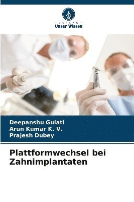 bokomslag Plattformwechsel bei Zahnimplantaten