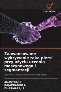 bokomslag Zaawansowane wykrywanie raka piersi przy u¿yciu uczenia maszynowego i segmentacji