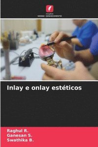 bokomslag Inlay e onlay estéticos