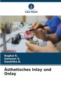 bokomslag Ästhetisches Inlay und Onlay