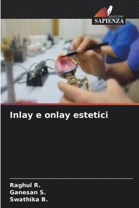 bokomslag Inlay e onlay estetici