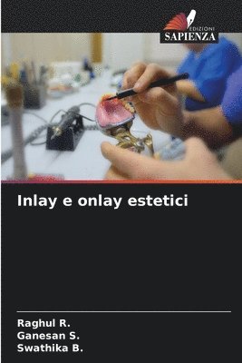 bokomslag Inlay e onlay estetici