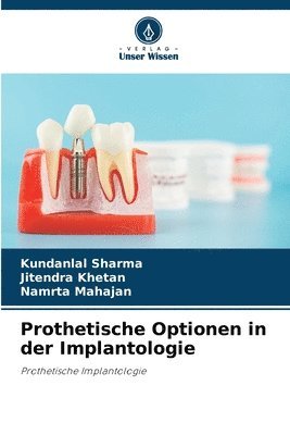 bokomslag Prothetische Optionen in der Implantologie