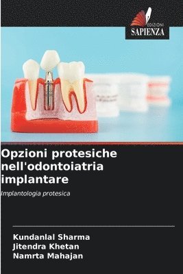 bokomslag Opzioni protesiche nell'odontoiatria implantare