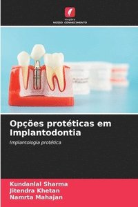 bokomslag Opções protéticas em Implantodontia