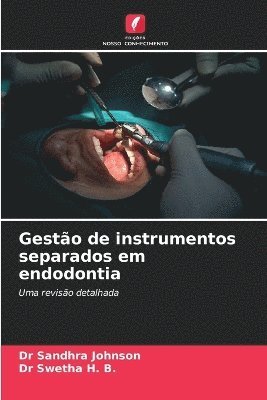 Sandhra Johnson, Swetha H B, Swetha H. B., Dr Sandhra Johnson, Dr Swetha H. B. - Gestão de instrumentos separados em endodontia, Häftad